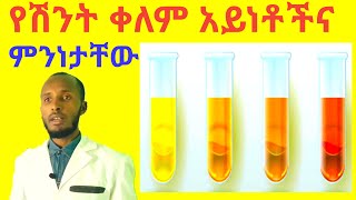 የሽንት ቀለም መቀየር ምክንያቶችና ምንነታችዉ Urine color changes and Their meaning about our Health.