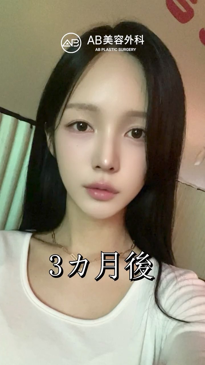 輪郭が整うと、ここまで女性らしくなる。 #shorts