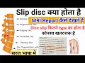 Slip disc disc prolapse       type    mri report  