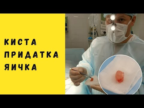 Видео: Разница между раком яичка и кистой (кистой мошонки)