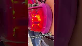 Does Non Surgical Breast Lift Vacuum Really Work? Watch This To Find Out