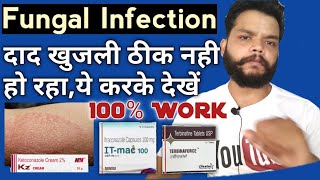 दाद खुजली ठीक नही हो रहा क्या | Fungal Infection allopathic Treatment In Hindi | Gyanear