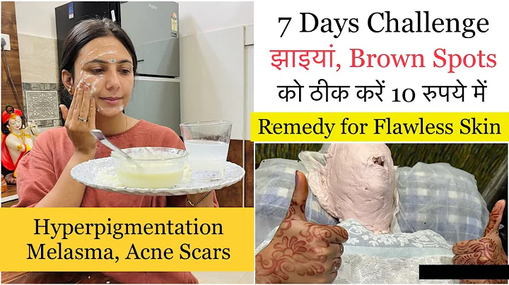 7 Days Challenge for Hyperpigmentation Dark Spots Melasma Flawless Glowing Skin | Dr. Upasana Vohra