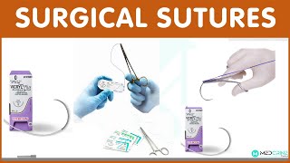 Surgical Sutures: Classification, types, examples and uses