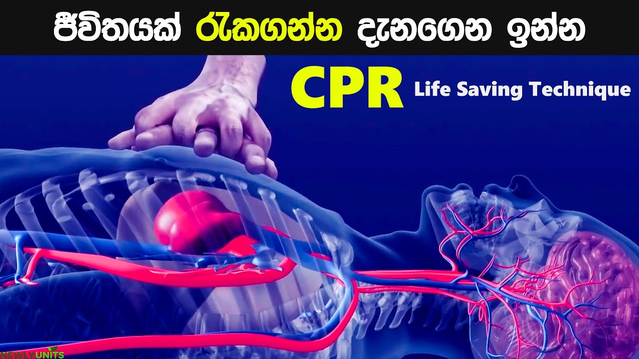CPR ලබා දීම 😨| How Cardiopulmonary Resuscitation ( CPR ) is performed ...