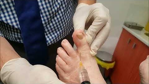 Digital block great toe