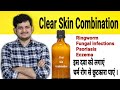 Homeopathic clear skin combination  fungal infections ringworm psoriasis skin disease eczema 