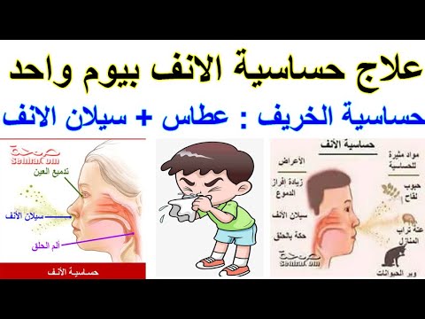 فيديو: كيفية التوقف عن العطس: أساطير وحقائق حول الحساسية