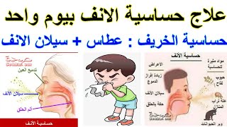 علاج العطاس وسيلان الأنف بيوم واحد