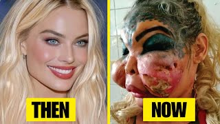 45 Celebrity Plastic Surgery Disasters You’d Never Recognize Today | Then and Now 2025