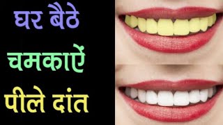 पीले दांतो को चमकाने का सिंपल सा घरेलू उपाय! tips for bright teeth! #shorts! kanha ladies care!