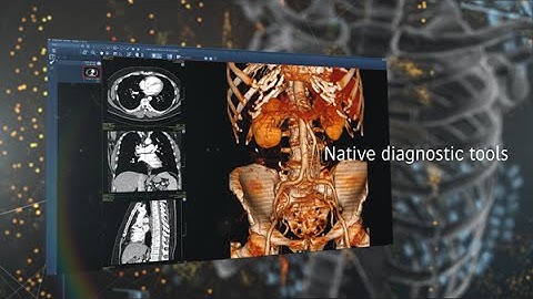Enterprise Imaging for Radiology