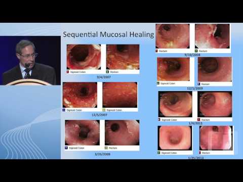 Video Endoscopy Dan Colonoscopy Adalah Video Endoscopy Dan Colonoscopy Adalah