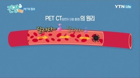 CT,PET란 어떤 검사인가? / YTN 라이프