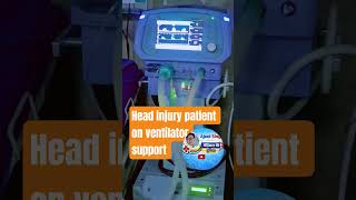 🧠 Head Injury Patient on Ventilator Support | Ventilator Management & Critical Care