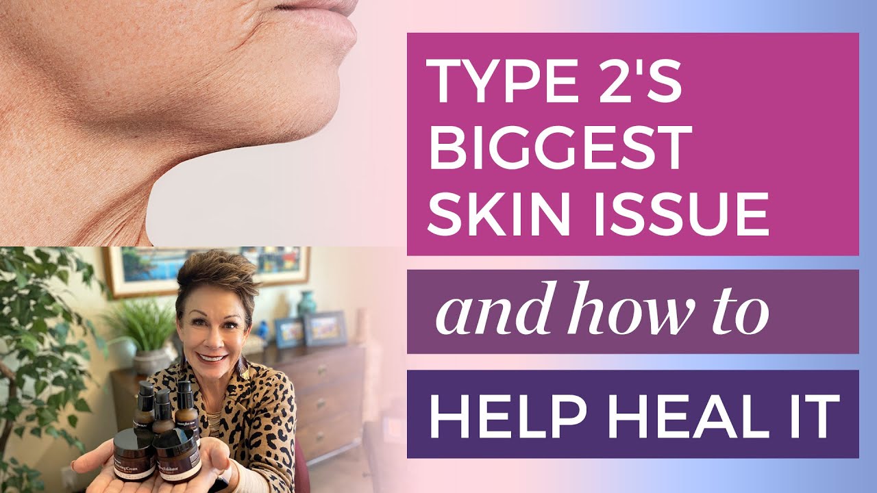 Type 2: How to Treat Jowls Without Surgery | Carol Tuttle 