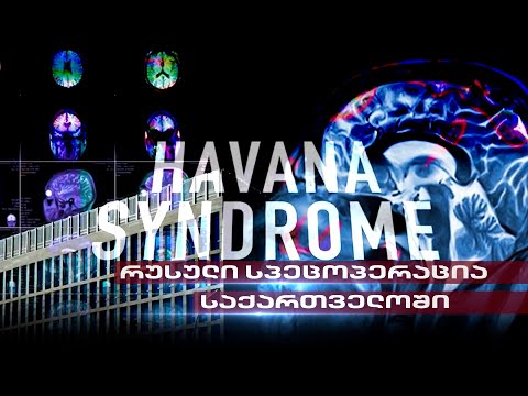 \"ჰავანას სინდრომი\" | რუსების სპეცოპერაციები და კრემლის აგენტები საქართველოში