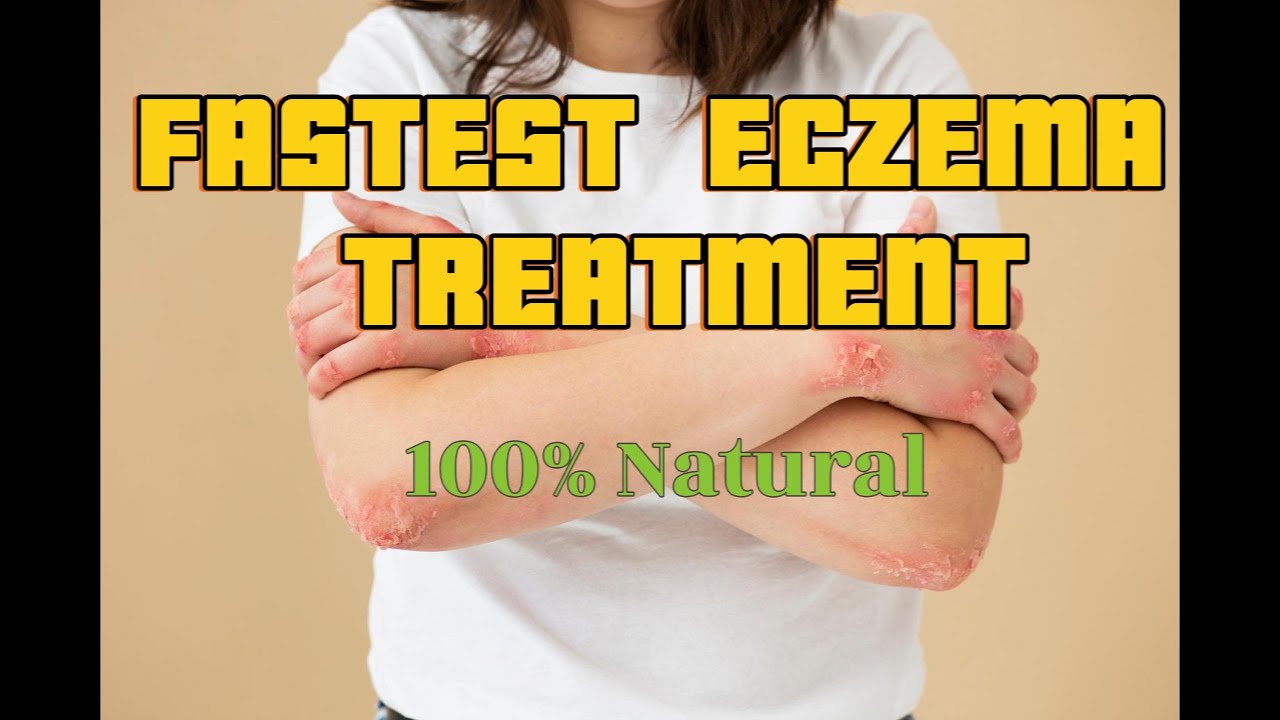 How to get Rid of eczema scars on the face, lips, scalp, hands etc. #