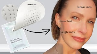 How to GET RID of WRINKLES !! Qure Targeted Infusion Micro Patches Review! (AD)