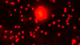 Rep Particle Adhesion With Dc Voltage