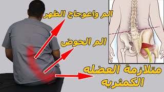 متلازمة العضلة الكمثرية (عرق النسا الكاذب)/السر وراء متلازمة العضلة الكمثرية وعلاجة