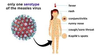 Measles (Genus Morbillivirus)