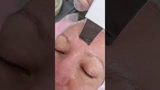 Аппаратные Чистки Лица Ультразвук, Гидропилинг, Вакуум