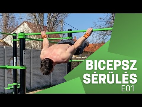 Videó: Bicepsz Tenodesis: Helyreállítás, Hatékonyság, Eljárás és így Tovább