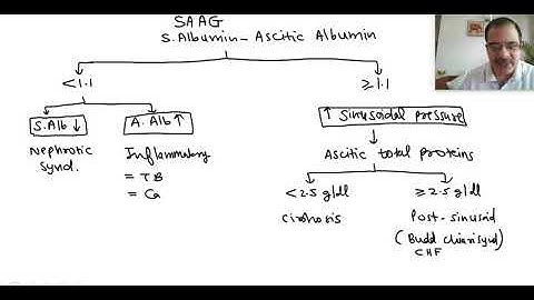 Clinical approach to a case of ascites | Dr Arvind Kumar