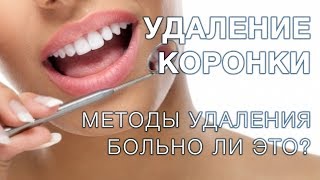 Что делать, если выпала коронка? Причины и как поставить протез на место — ROOTT