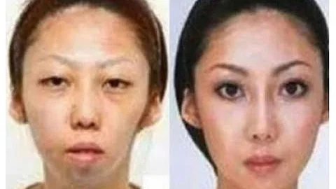 China Uncensored - Man Sues Wife Over Secret Plastic Surgery - and Wins! | NTD China Uncensored | NTDonChina - DayDayNews