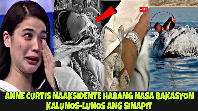 ACTRESS NA SI ANNE CURTIS NAAKSIDENTE HABANG NASA BAKASYON | KALUNOS-LUNOS ANG SINAPIT