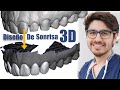 Diseño de sonrisa en 3D en Meshmixer