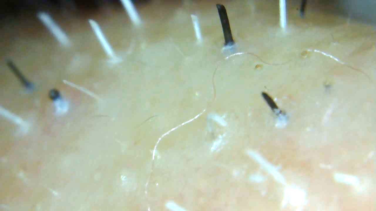 Plucker for facial hair Clearance