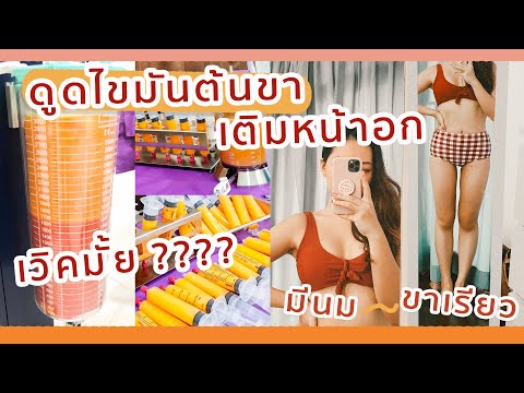 รีวิวดูดไขมันต้นขา เติมไขมันหน้าอก ปังหรือพัง ? | dreamnachon