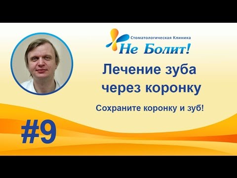 Лечение зуба через коронку