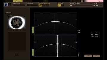 Canon Xephilio A1 e HS100  - esame del segmento anteriore
