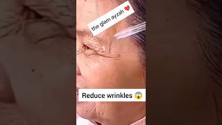 Miracle Serum for Reduce wrinkles & open pores shorts shortvideo viral skincare