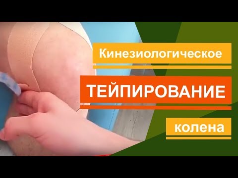 Кинезиологическое тейпирование колено