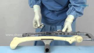 Femur Nail- Universal Femur Nail