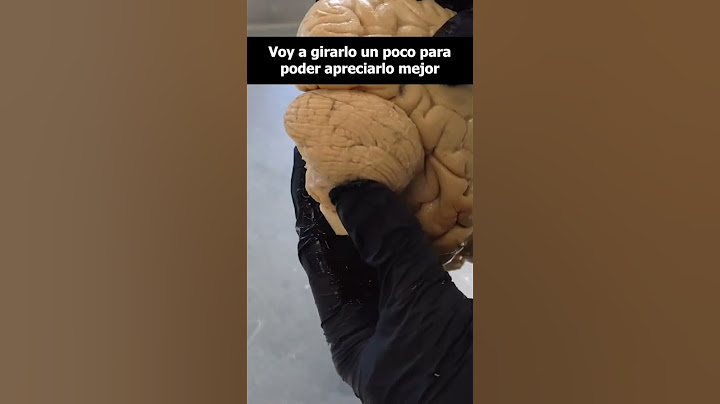 El... ¿CEREBELO?