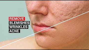 Photoshop Tutorial | How to Quickly Smooth Skin and Remove Blemishes & Scars from face