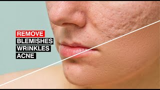 Photoshop Tutorial | How to Quickly Smooth Skin and Remove Blemishes &amp; Scars from face