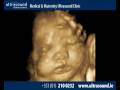 Pregnancy scan  dublin ireland  ultrasound pregnancy