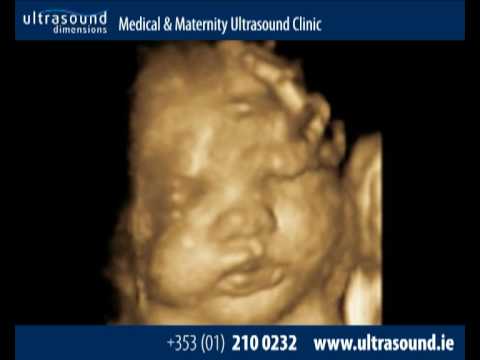 Pregnancy - Dublin Ireland - Ultrasound YouTube