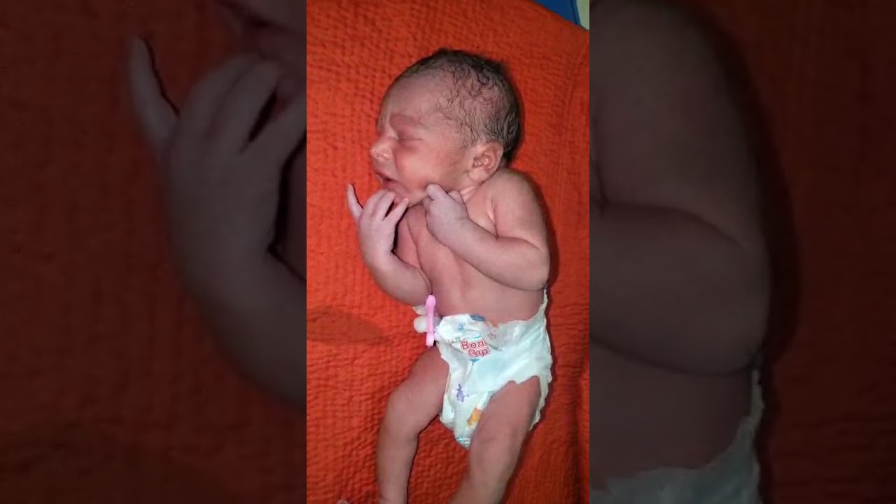 His finger move turn Newborn Baby Crying Immediately After Birth  How to Prone Newborn Baby Properly