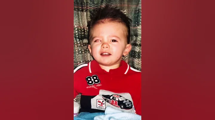 WHEN I LOST MY EYEBALL 😮