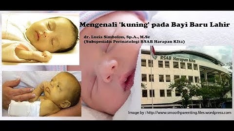 Mengenali Kuning pada Bayi Baru Lahir (Ikterus pada Bayi) RSAB Harapan Kita