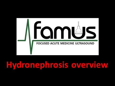 Hydronephrosis overview