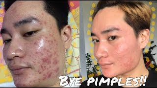 JOURNEY OF PROJECT KINIS NI SENYORA (BRILLIANT SKIN ESSENTIAL)